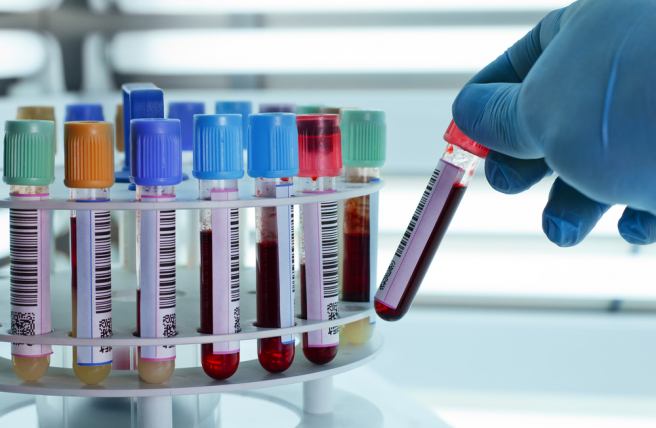 A new way of detecting cancer through RNA test of blood platelets discovered A new way of detecting cancer through RNA test of blood platelets discovered