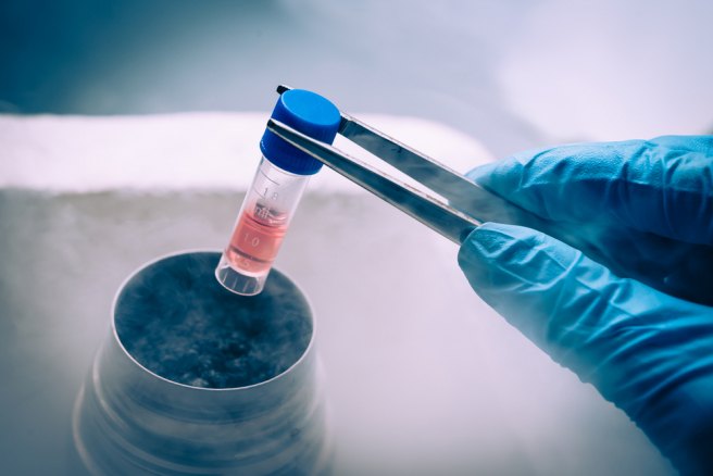 Mini-kidneys grown from stem cells for renal disease study Mini-kidneys grown from stem cells for renal disease study