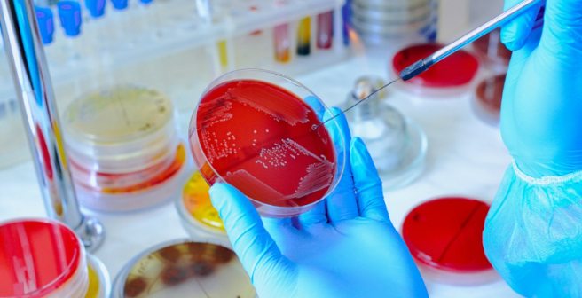 Style tips for presenting scientific names of bacteria Style tips for presenting scientific names of bacteria