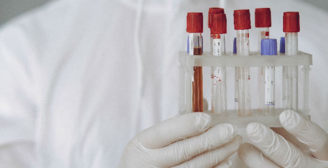 A micro-lab on a chip detects blood type within minutes A micro-lab on a chip detects blood type within minutes